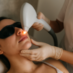 Épilation laser moustache femme : avis, efficacité et précautions à connaître